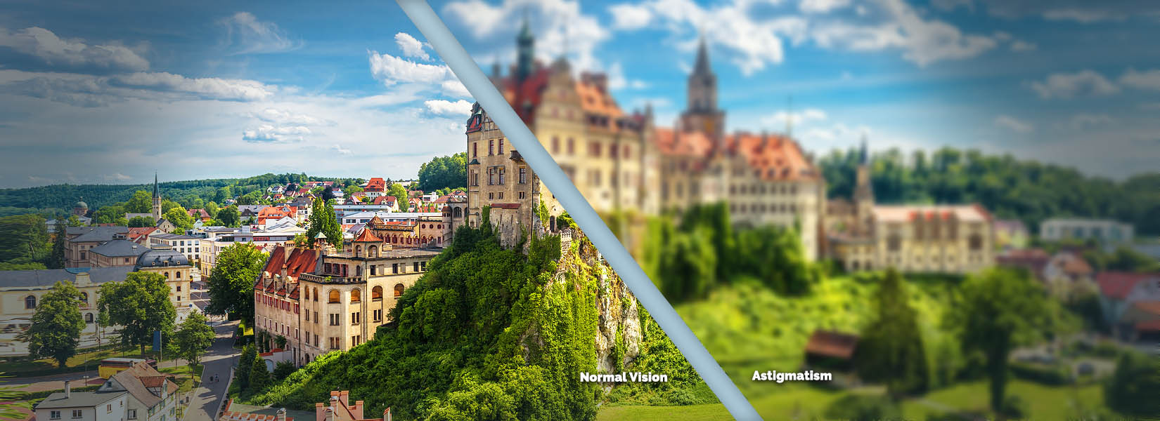 Astigmatism Treatment in East El Paso