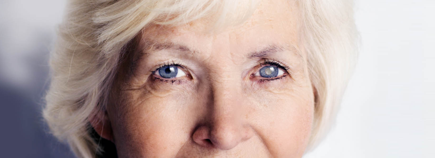Cataract Surgery in East El Paso